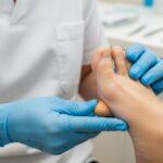 nagelpilz-behandlung-podologe-lack